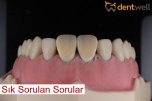 Sık Sorulan Sorular